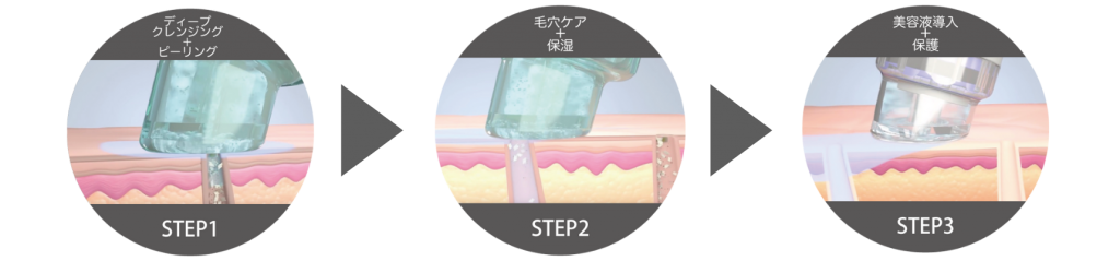 SSCビューティークリニック ハイドラフェイシャル 施術フロー　step1→step2→step3